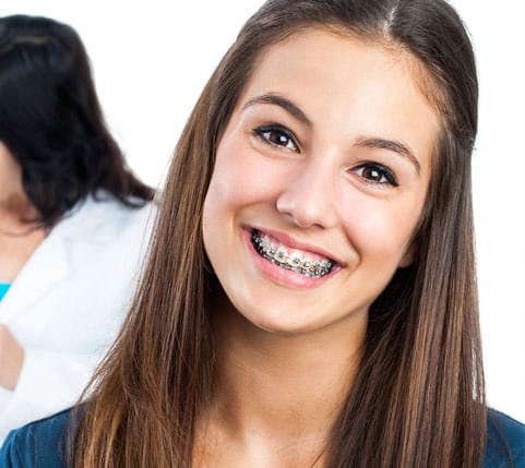 Braces - Orthodontic braces