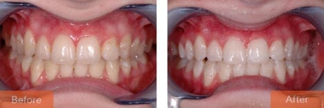 teeth whitening 470x157 - Cosmetic Dentistry